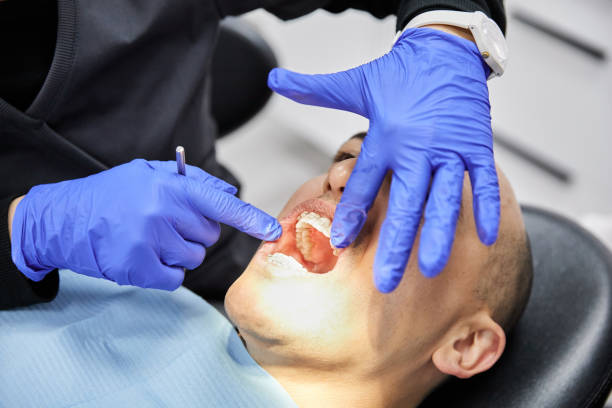 Best Emergency Wisdom Tooth Extraction in Tye, TX